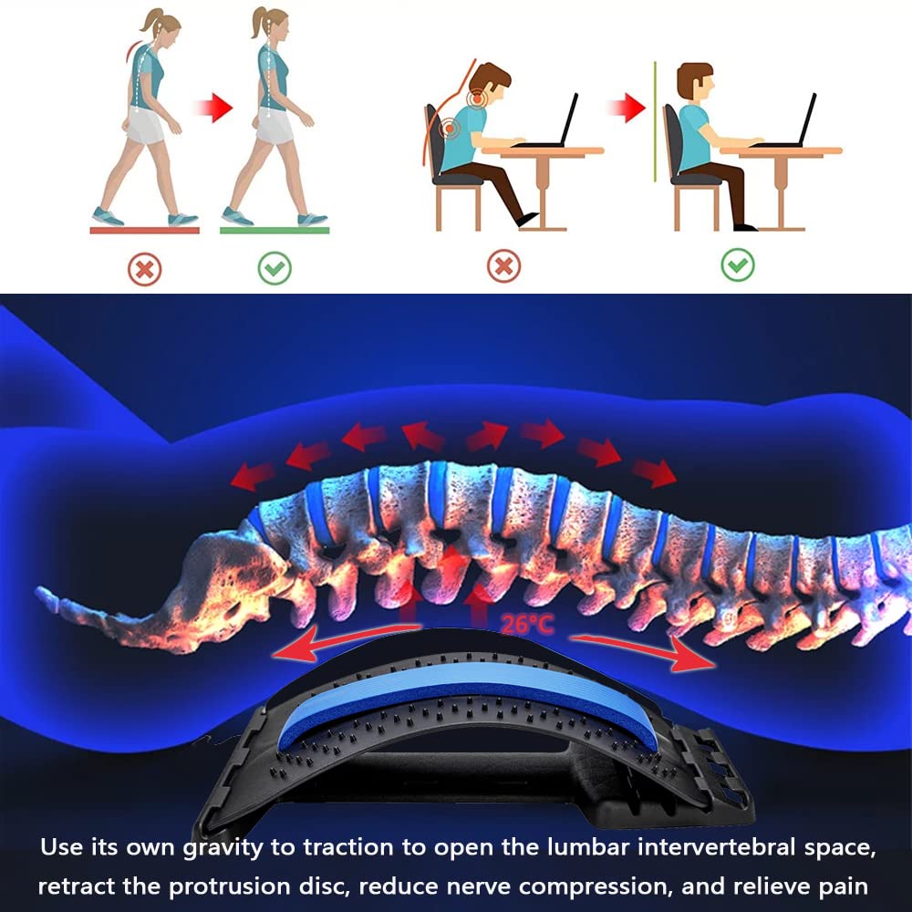 Savoy - Back Stretcher for Lower Back Pain Relief, Multi-Level Lumbar Support Stretcher - Spinal Back Massager - 1 COLOR -