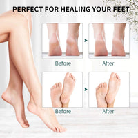 Thumbnail for Savoy - Electric Callus Remover, Rechargeable Electronic Feet File Hard Skin Remover -